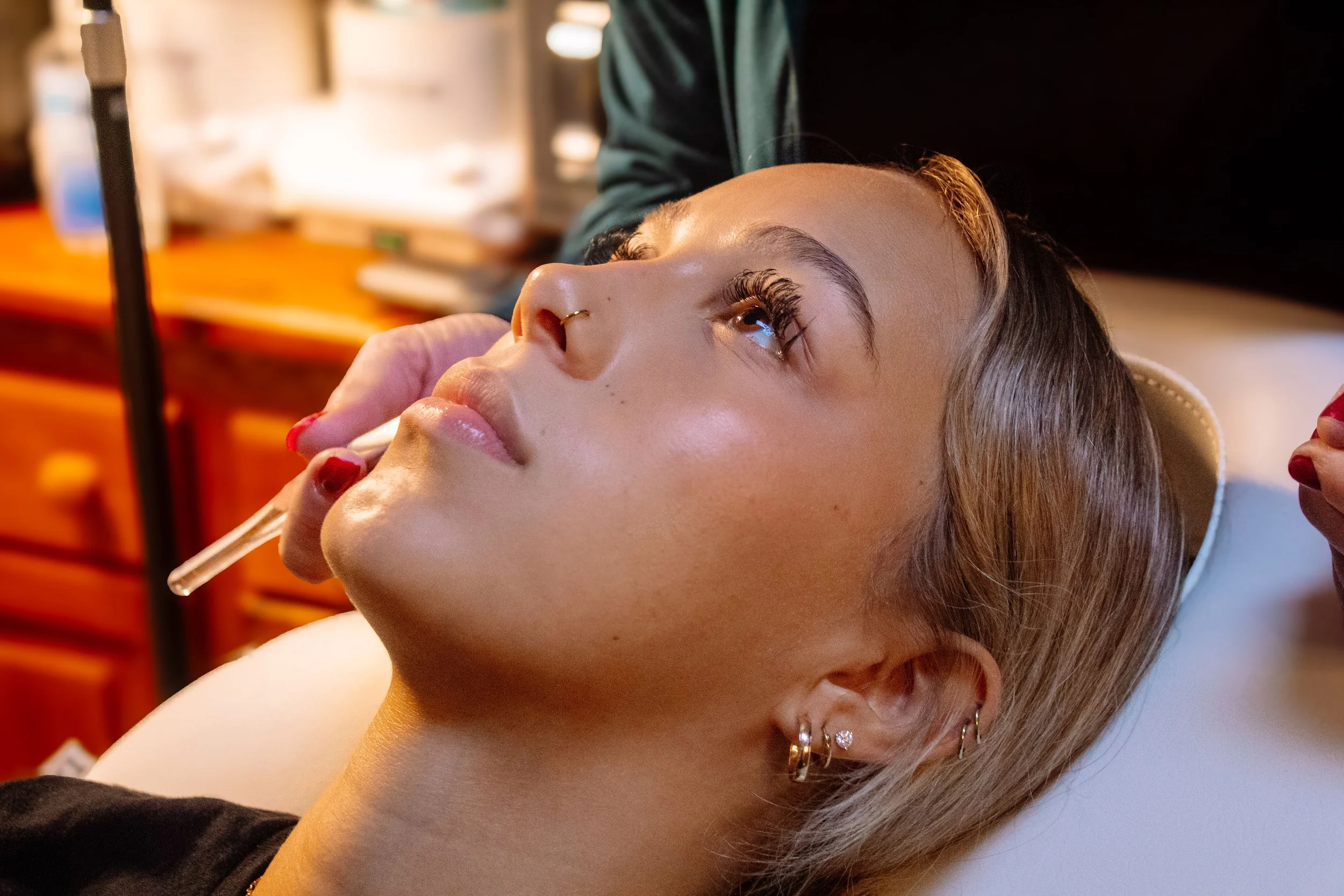 Microneedling with PRP in Nampa: Boost Your Skin Results Naturally