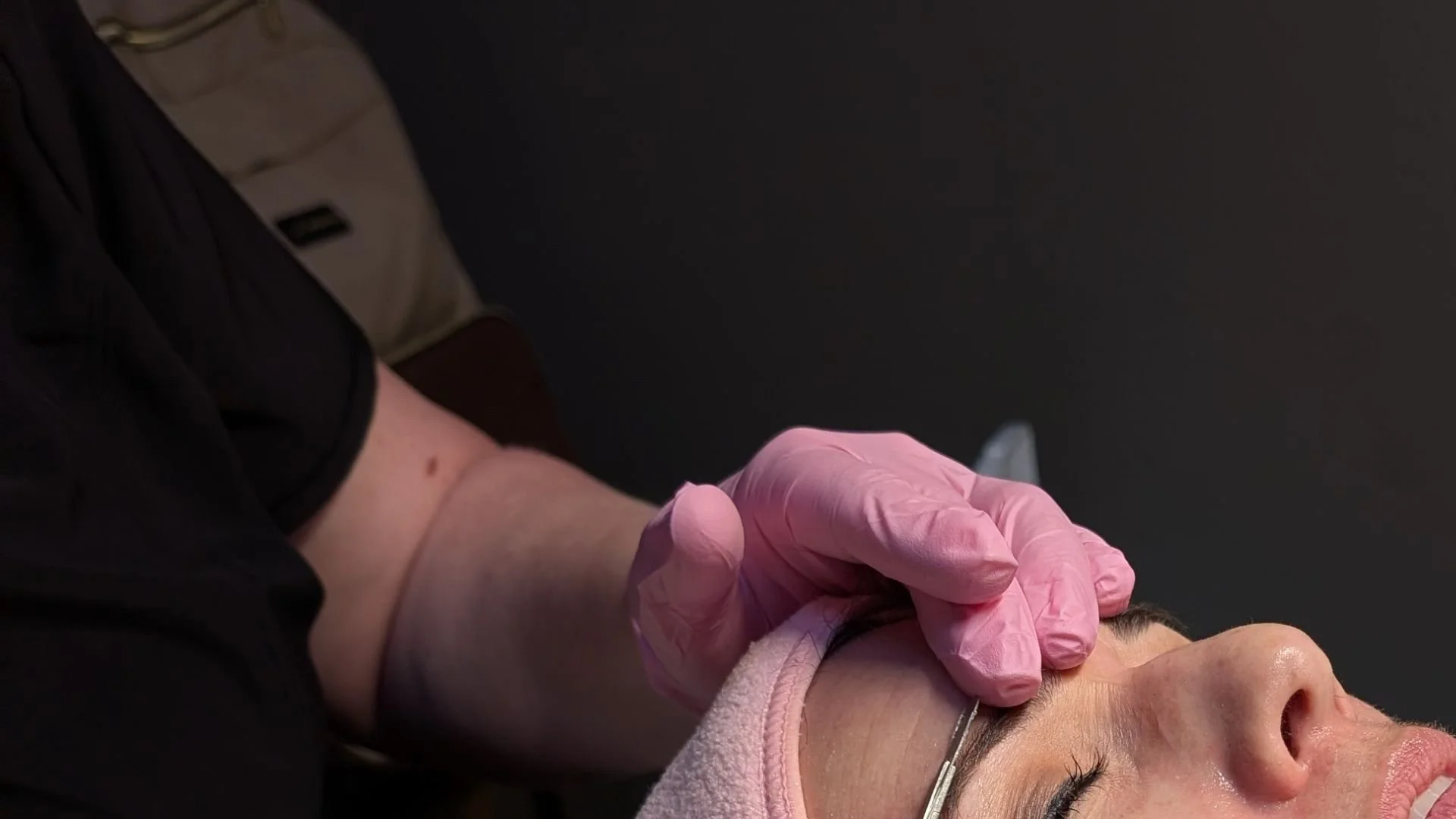 Acne Is Normal: Understanding Acne and the Best Treatments for Clearer, Healthier Skin If you've ever struggled with acne, you're not alone.