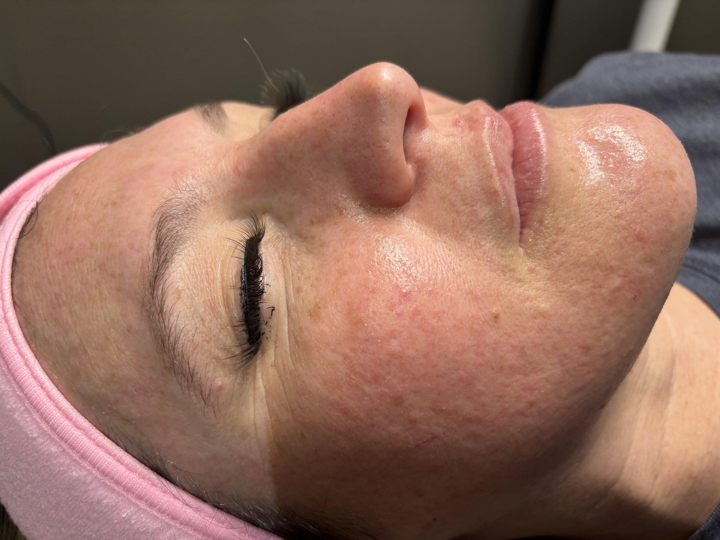 Tried, True, and Backed by Science: Why We Don’t Chase Trends at Snake River Aesthetics