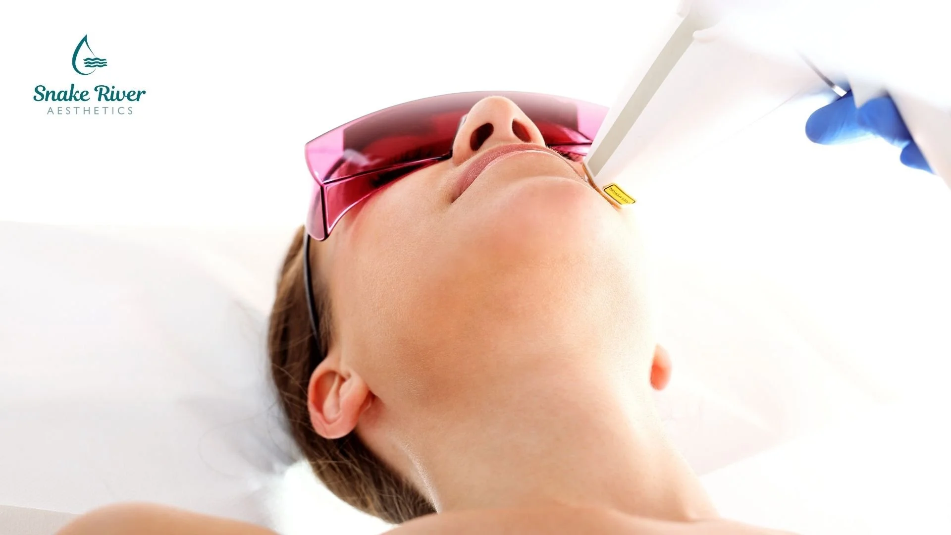 MultiFrax Laser: What to Expect Before, During, and After Your Skin Resurfacing Treatment