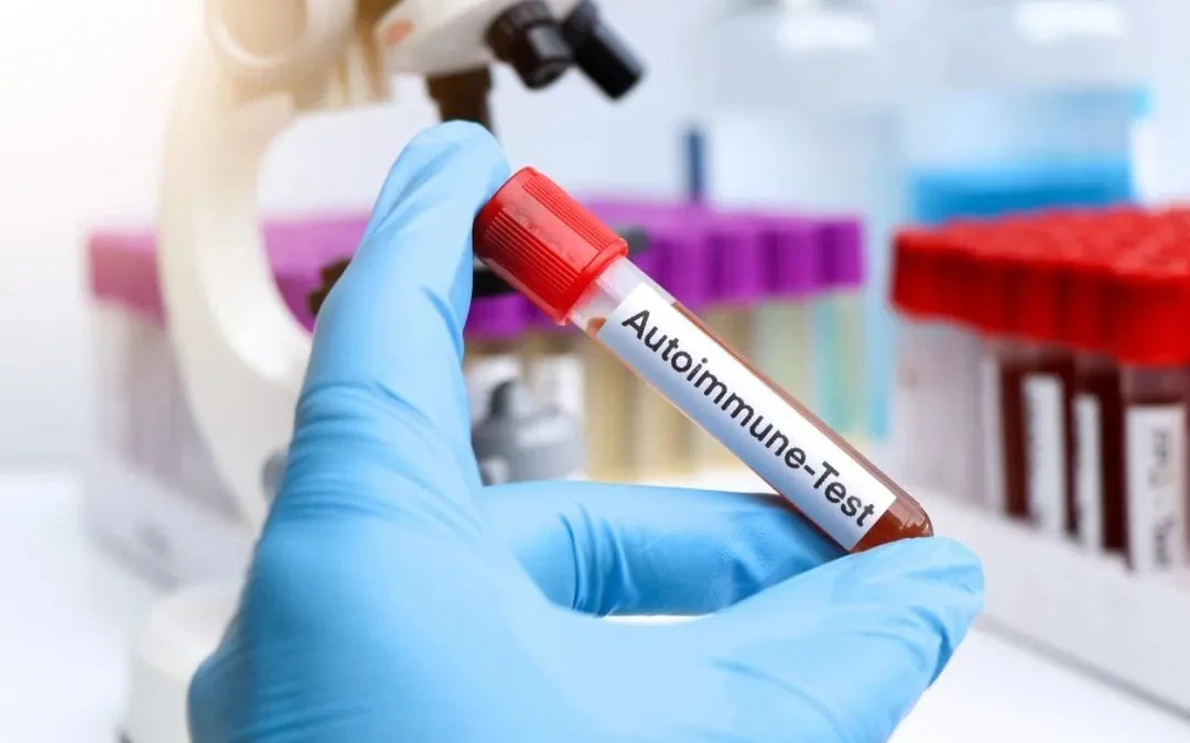 A gloved hand holding a test tube labeled 'Autoimmune-Test' in a laboratory setting with test tubes and lab equipment in the background.