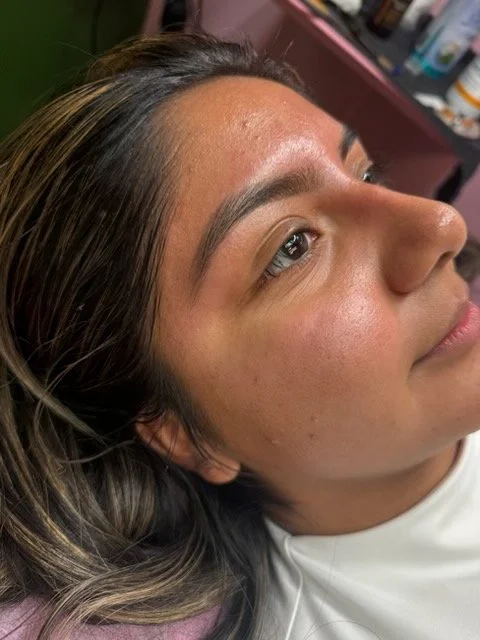Close-up of a person's face, showing the eyebrow, eyelash, and part of the eye, with clear skin and some small moles.
