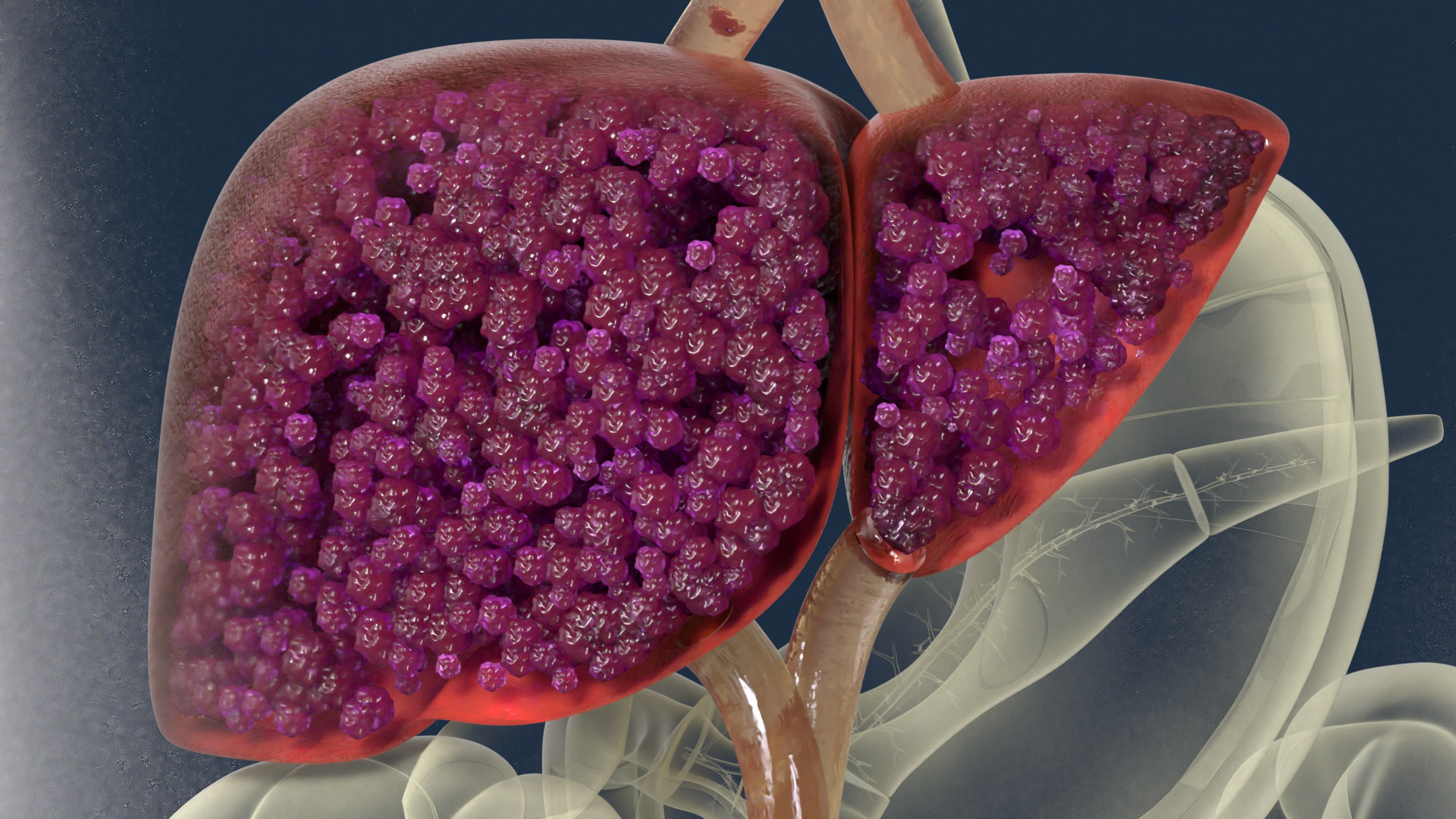 LIVER 3DCG