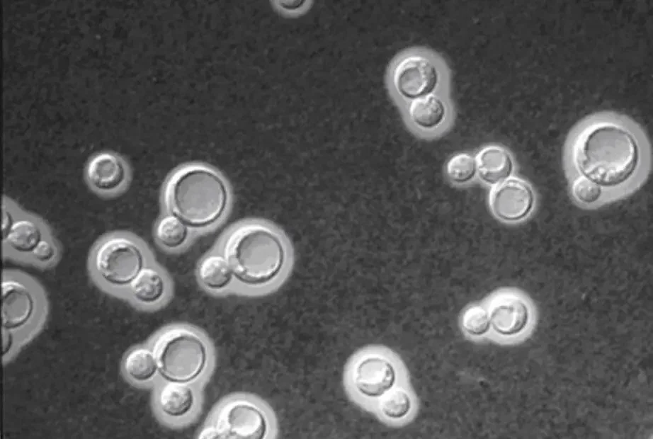 Cryptococcus-neoformans-922x620-1-1256474813.jpg
