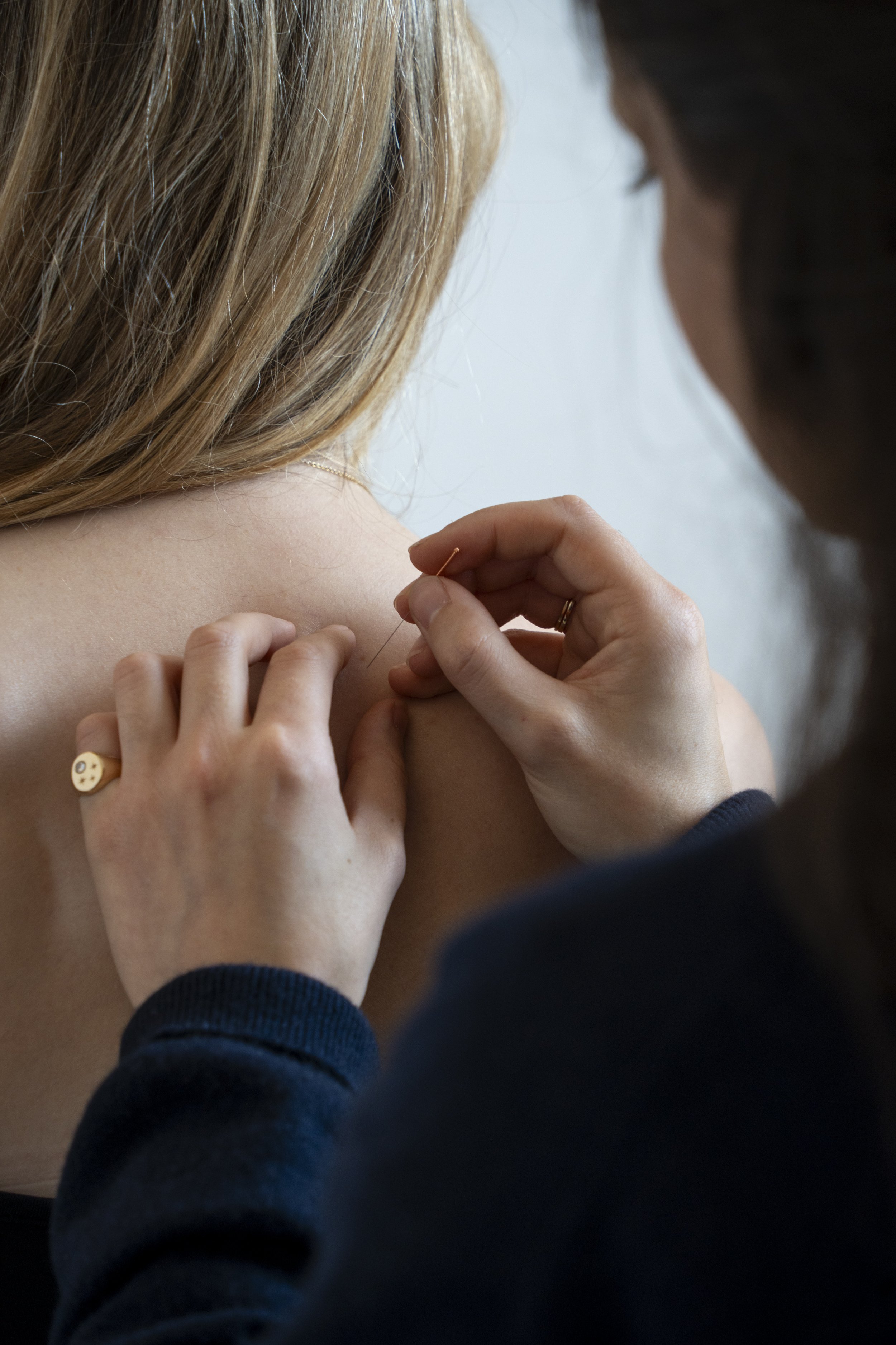 Acupuncturist Emily performing a Five Element Acupuncture treatment for a patient in her North East London clinic.