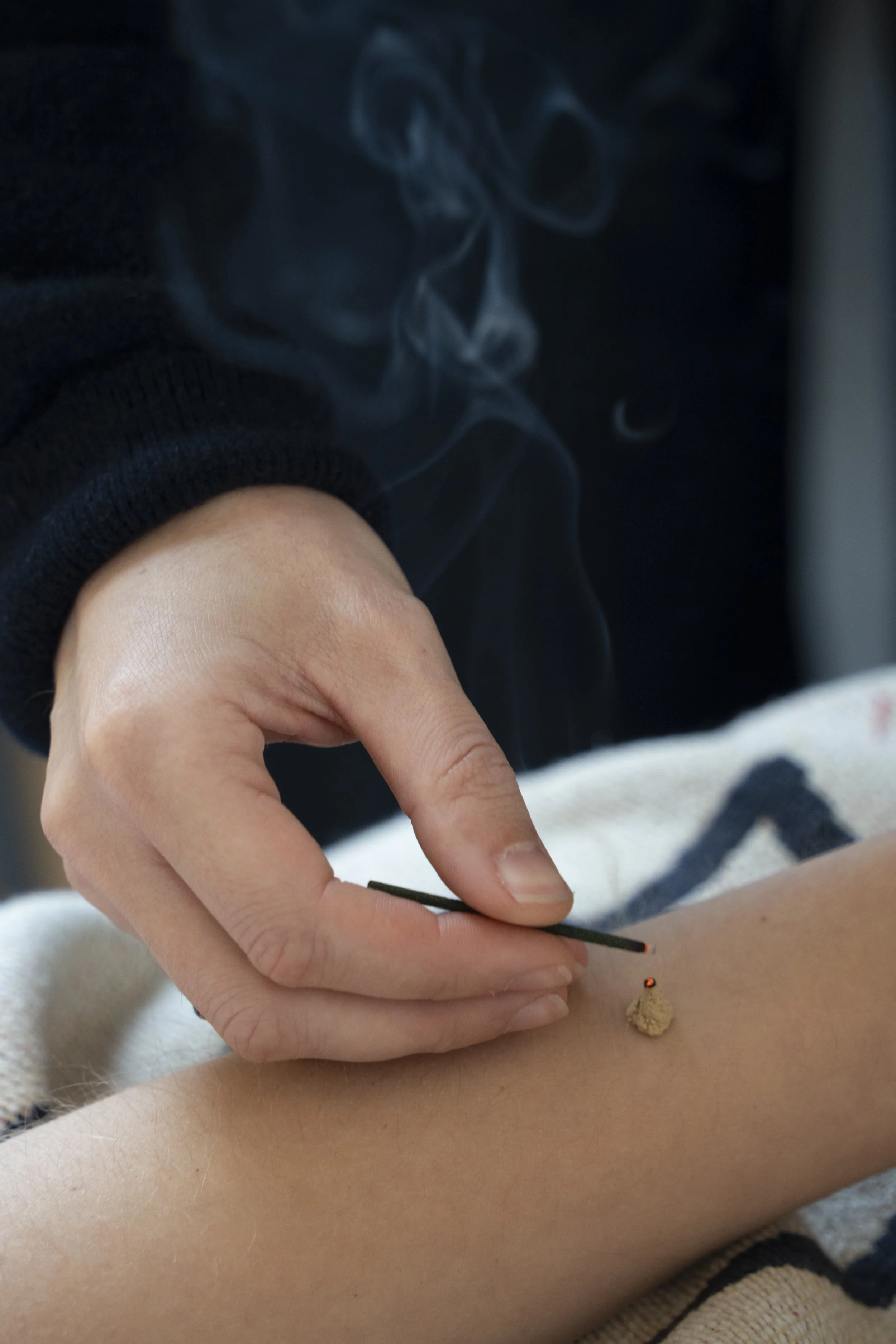 Close-up of moxibustion therapy, a traditional Five Element Acupuncture technique used to stimulate healing and Qi in a Hackney clinic.