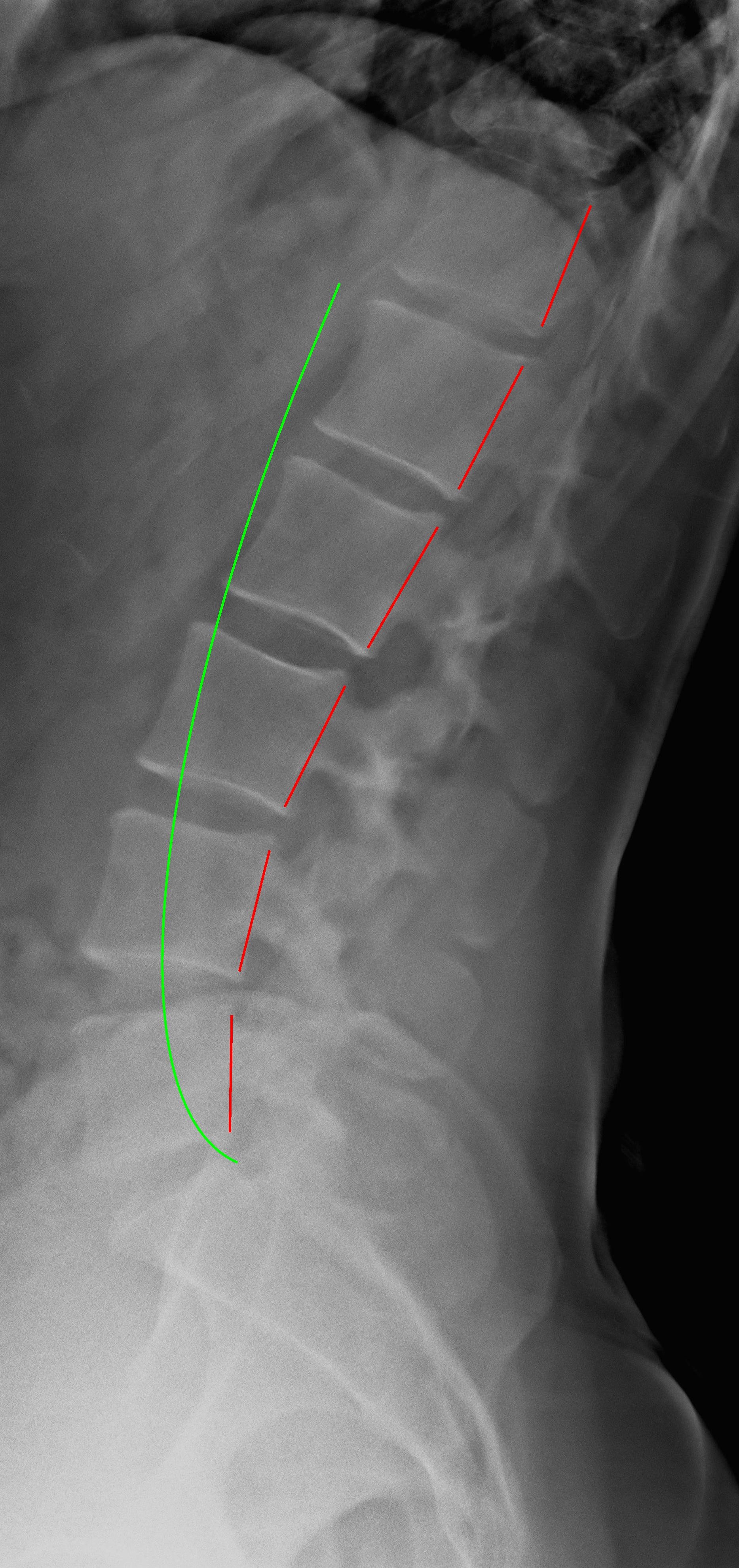 Struggling with low back pain?  Here’s how we help. 