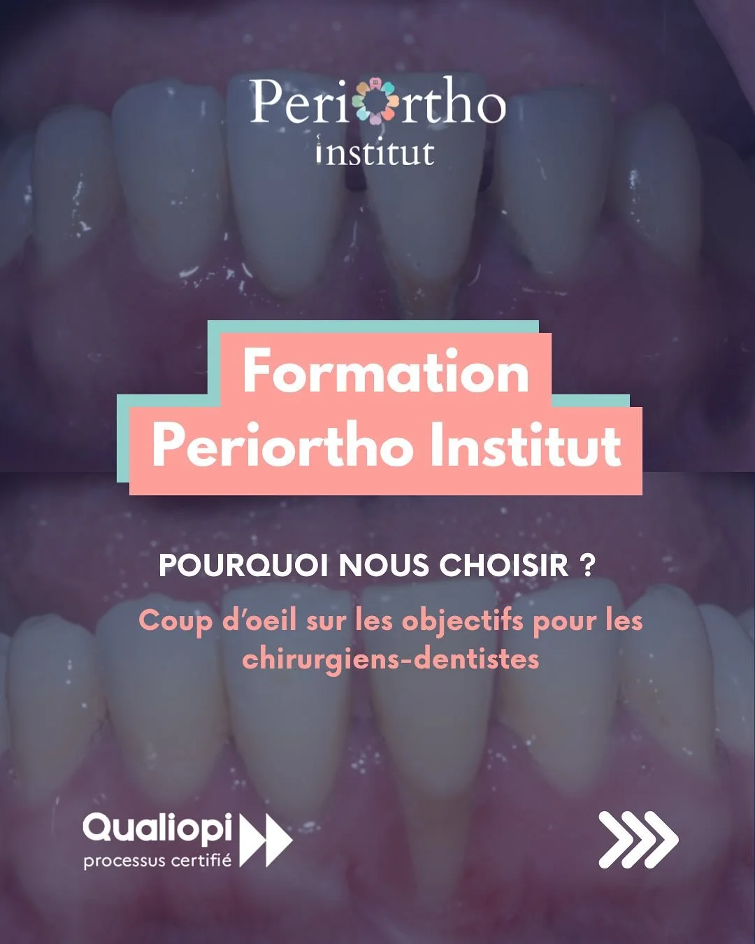 🦷 Vous &ecirc;tes chirurgien-dentiste et souhaitez approfondir vos connaissances en parodontologie ?

💼 Periortho Institut propose une formation sp&eacute;cialis&eacute;e, con&ccedil;ue pour enrichir votre pratique quotidienne avec des contenus ada