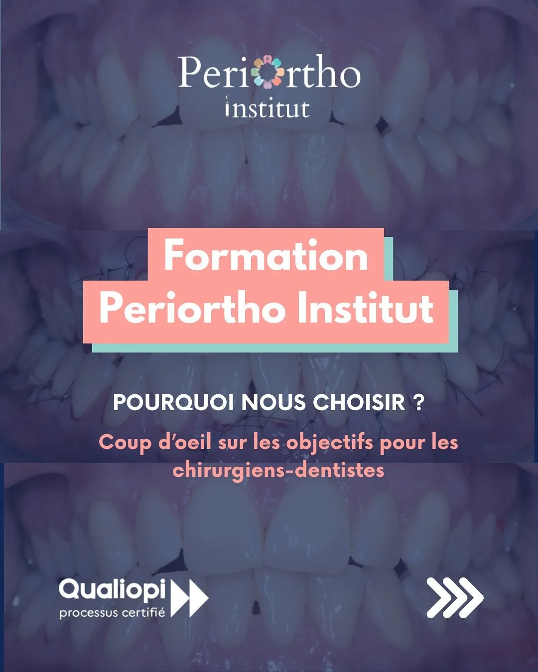 🦷 Vous &ecirc;tes chirurgien-dentiste et souhaitez approfondir vos connaissances en parodontologie ?

💼 Periortho Institut propose une formation sp&eacute;cialis&eacute;e, con&ccedil;ue pour enrichir votre pratique quotidienne avec des contenus ada