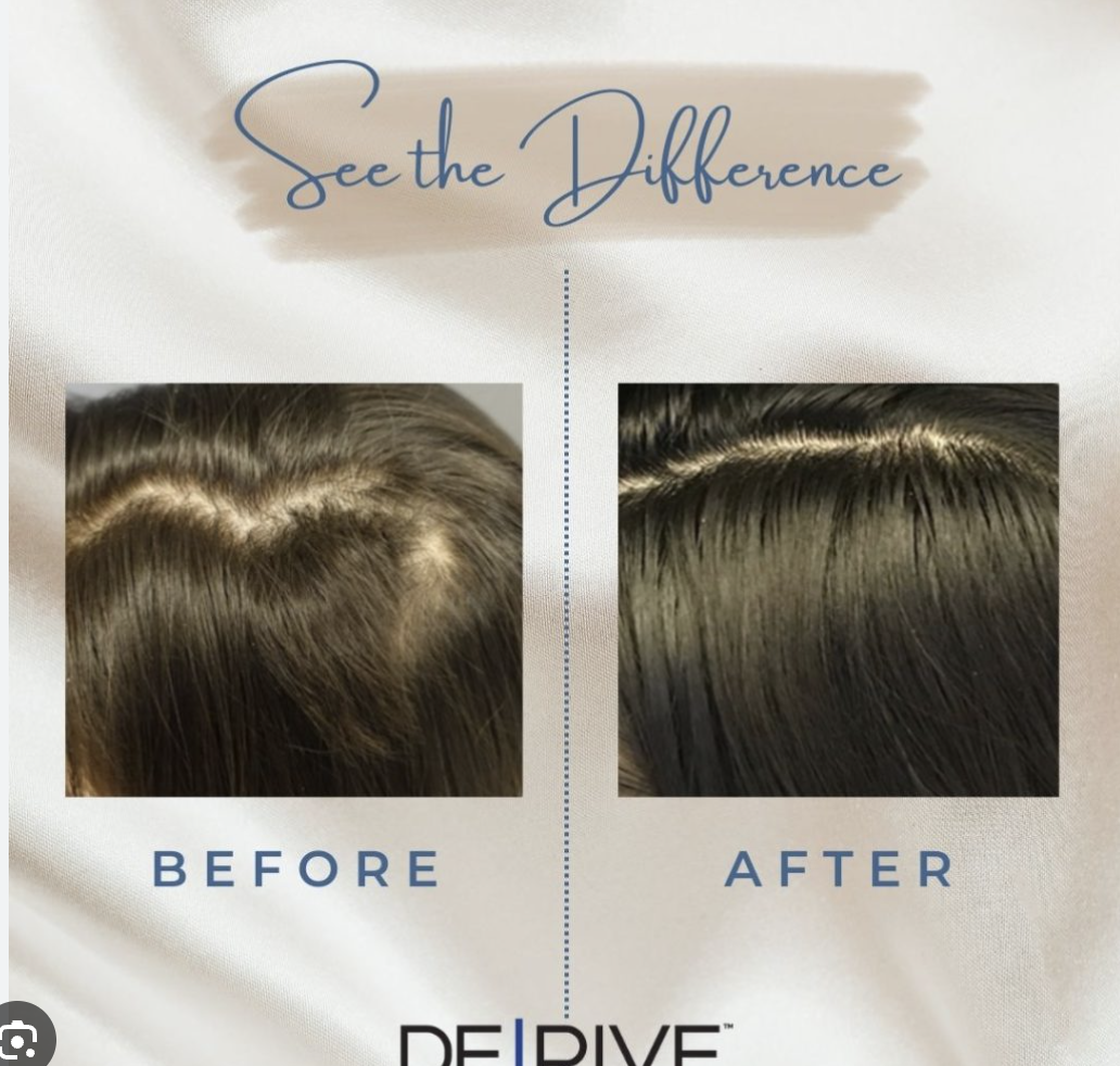 Side-by-side comparison of a person's scalp before and after hair treatment, showing improved hair density and health in the after image.