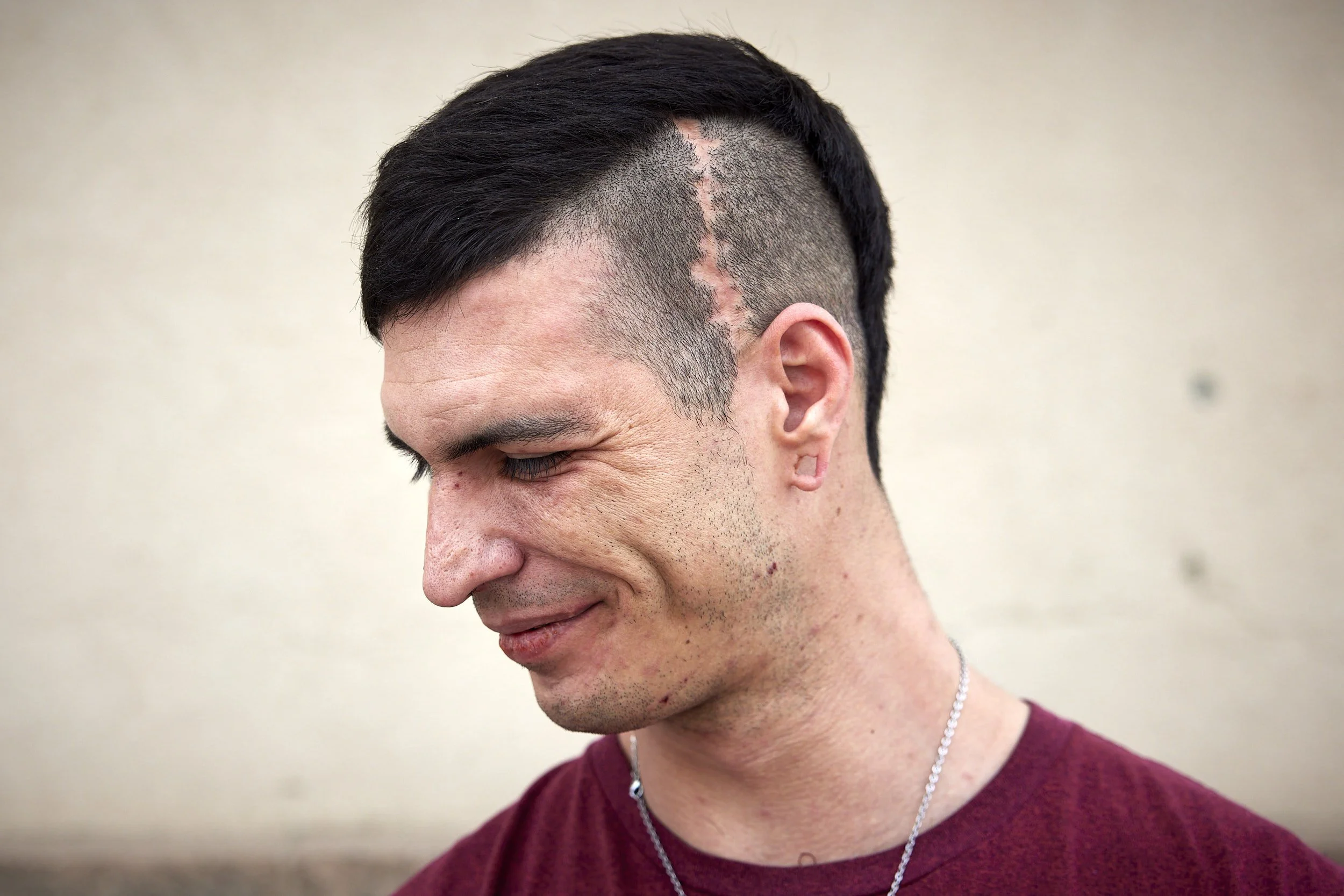 jimmy-galt_recovery-photographer_san-diego_49.jpg