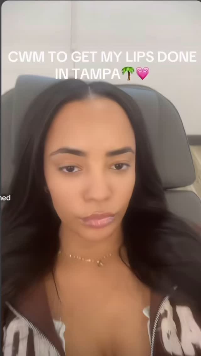 Come with me to get my lips done in Tampa 💋✨
Natural. Hydrated. Balanced.
Kate @drheromed understood the assignment.
If you’ve been thinking about it… this is your sign.
DM “Lips” or call/text 813-602-2030 to book your glo