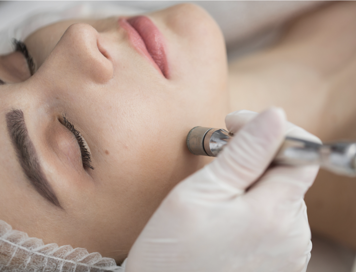 Woman receiving Liquid Microdermabrasion Aesthetics Treatment