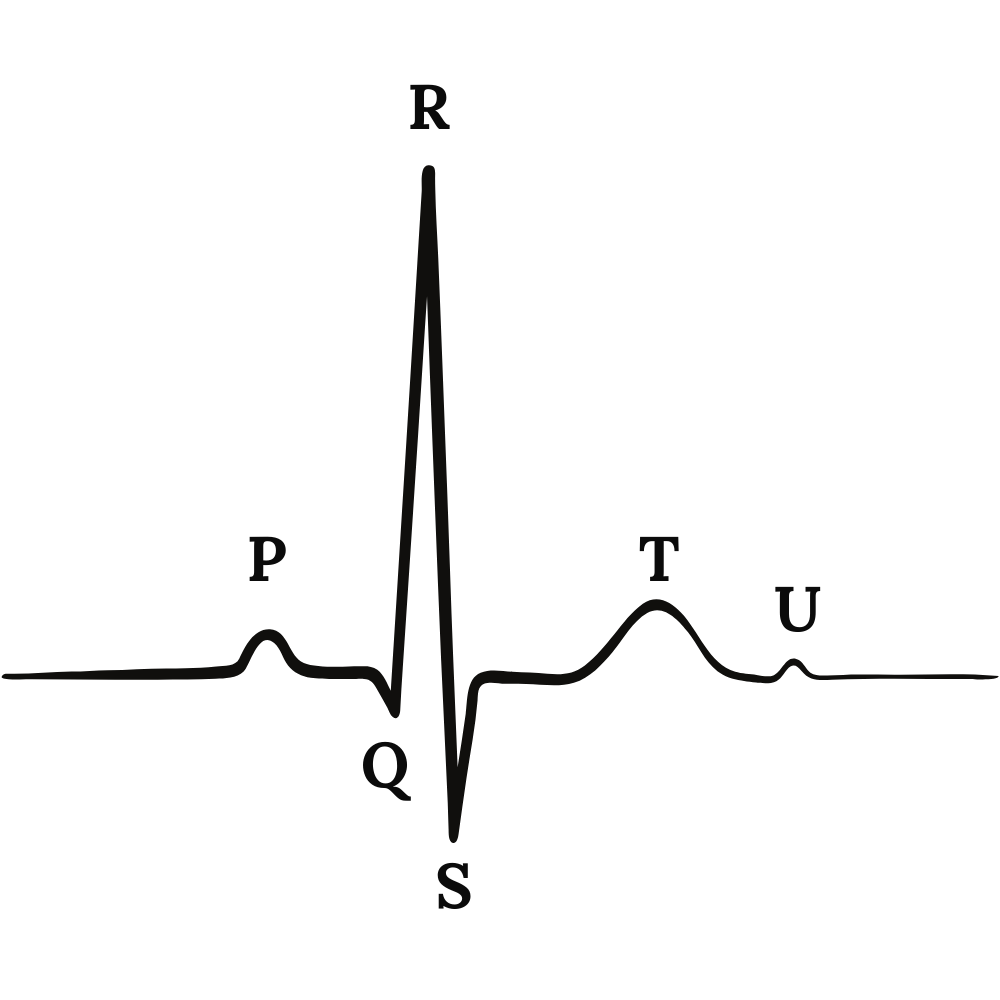 Electrocardiogram (ECG) tracing showing the P wave, QRS complex, and T wave.