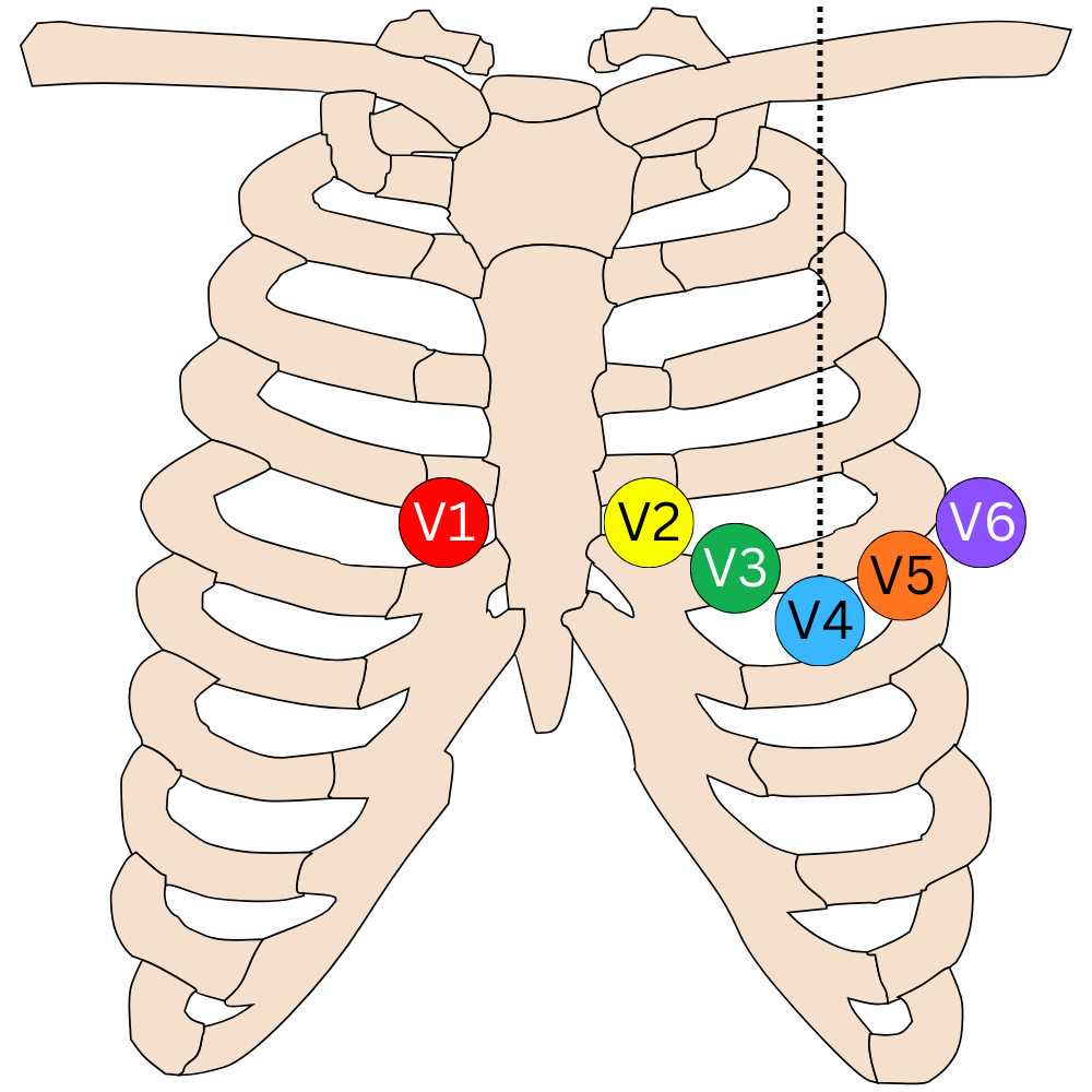 ECG chest lead placement