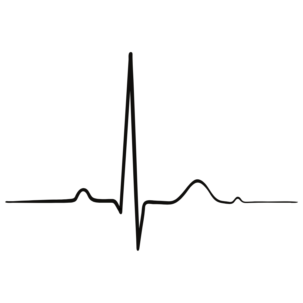 ECG PQRST complex