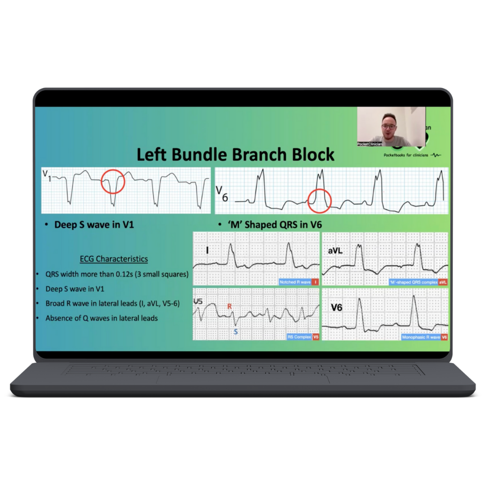 12 lead ecg video lecture