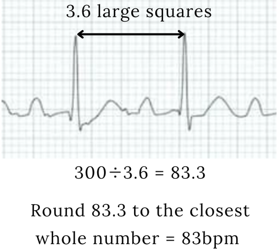 calculating rate on an ECG