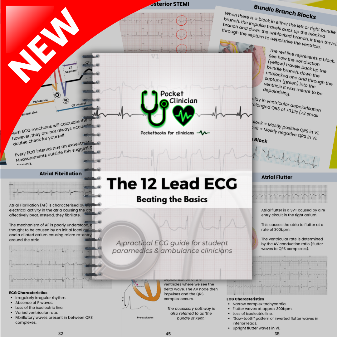 ECG Pocketbook