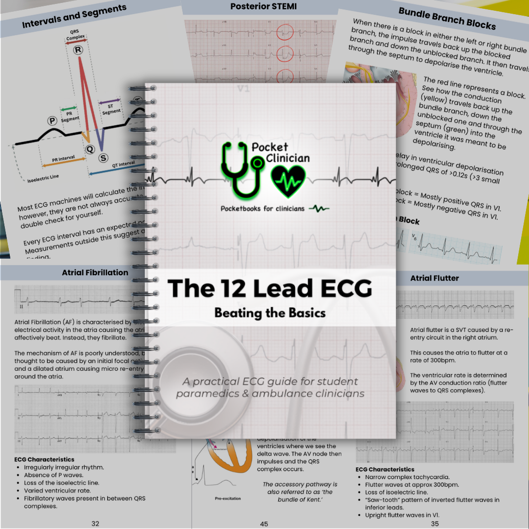 ECG Pocketbook