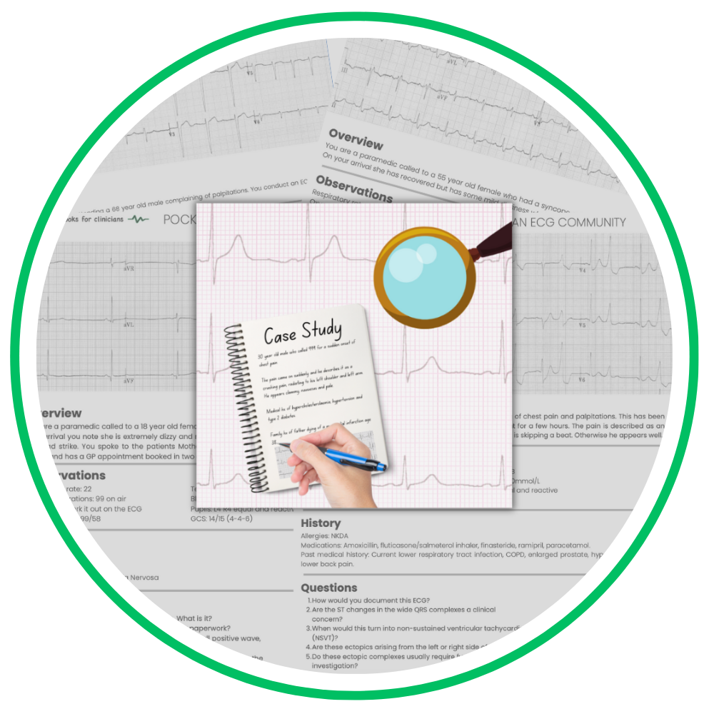 ECG Case studies