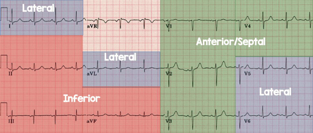 ECG reference