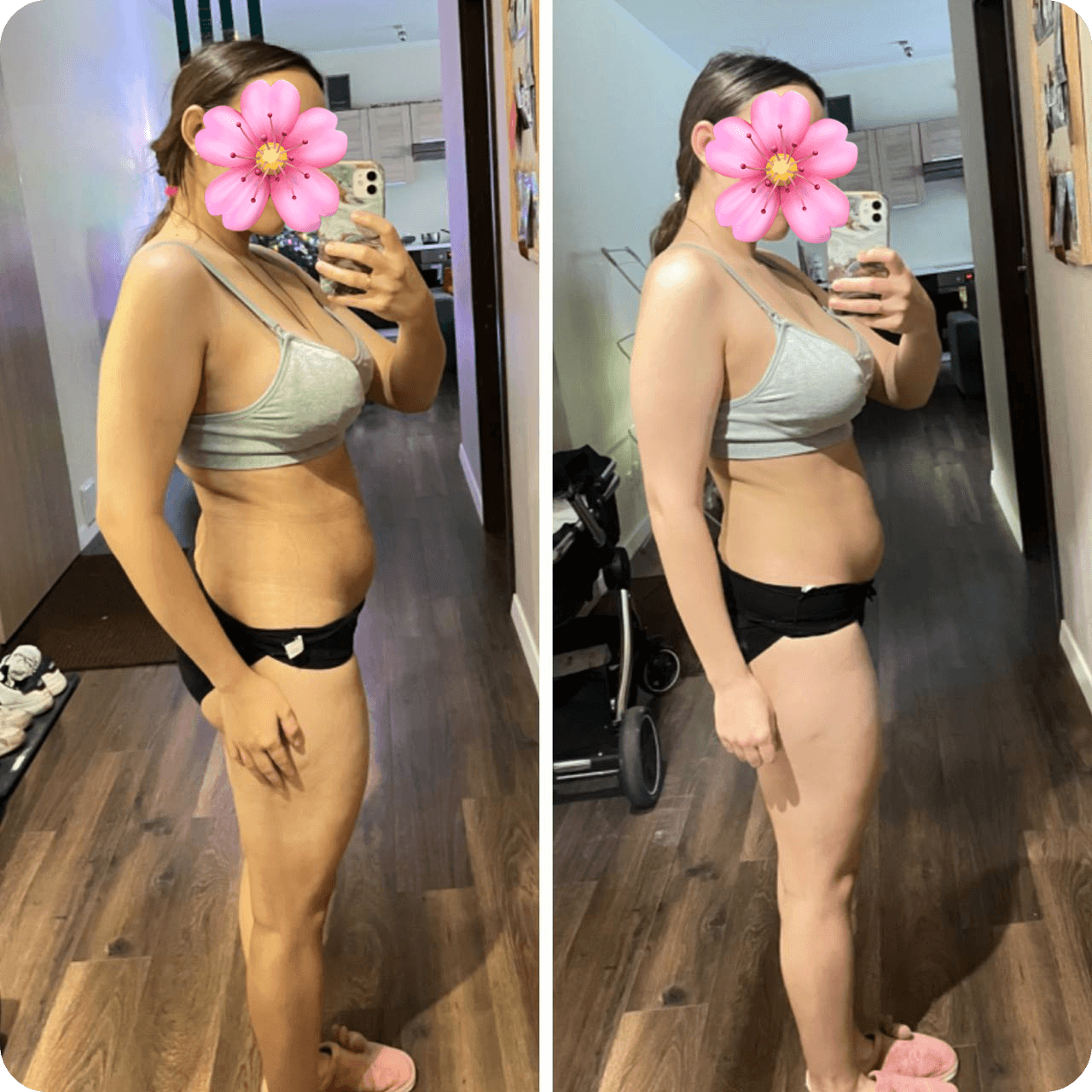 A side-by-side comparison of a woman's body transformation, wearing a sports bra and black shorts. The focus is on the abdominal area, showing before and after changes. Her face is covered with a pink flower graphic.