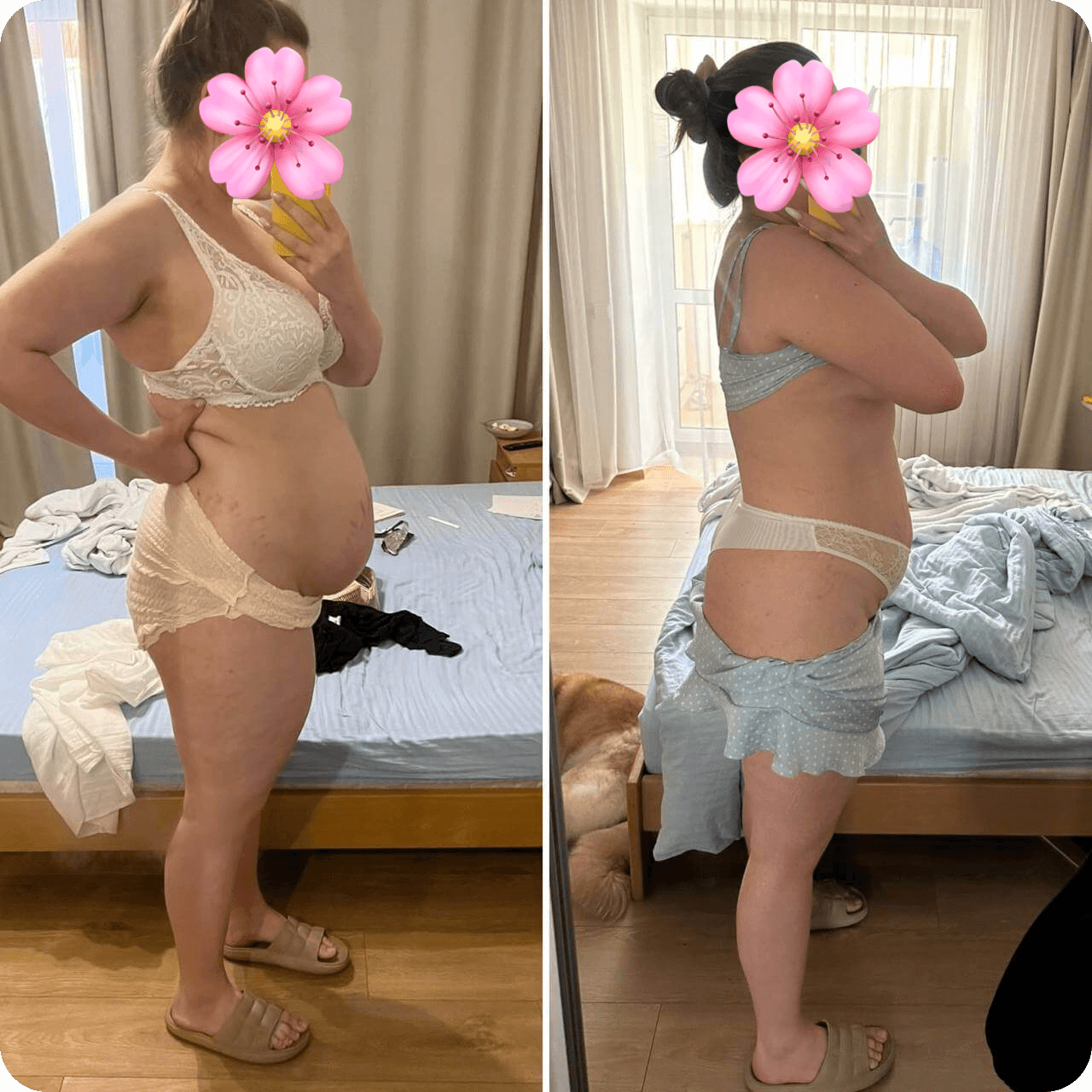 Side-by-side before and after weight loss comparison of a woman in underwear, with her face hidden by a flower sticker. The images show a noticeable change in her abdominal area. Bedroom setting with messy bedding.