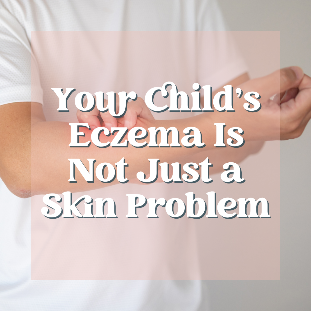 Your Child’s Eczema Is Not Just a Skin Problem