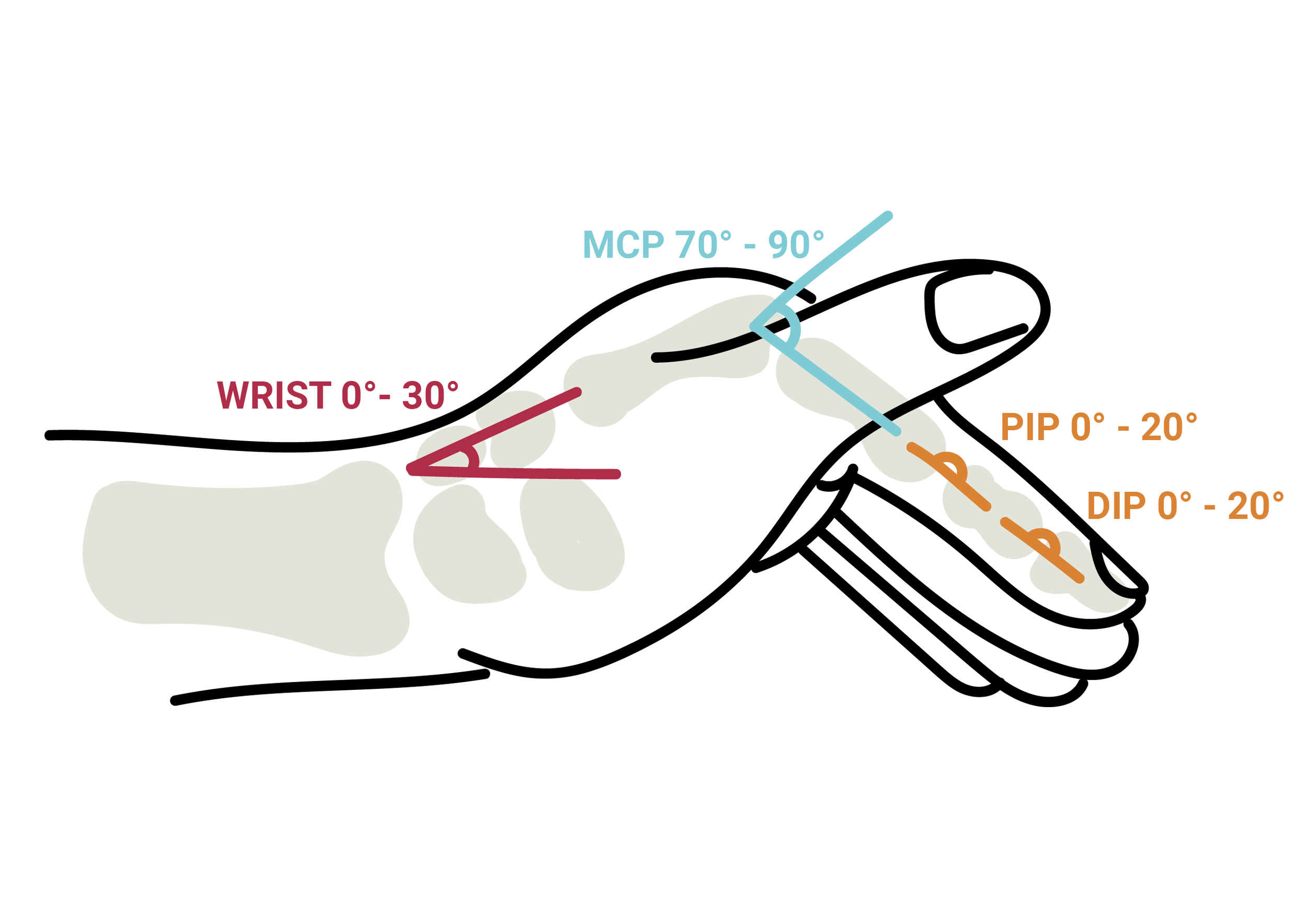 Hand Splintint Principles SafeSplint