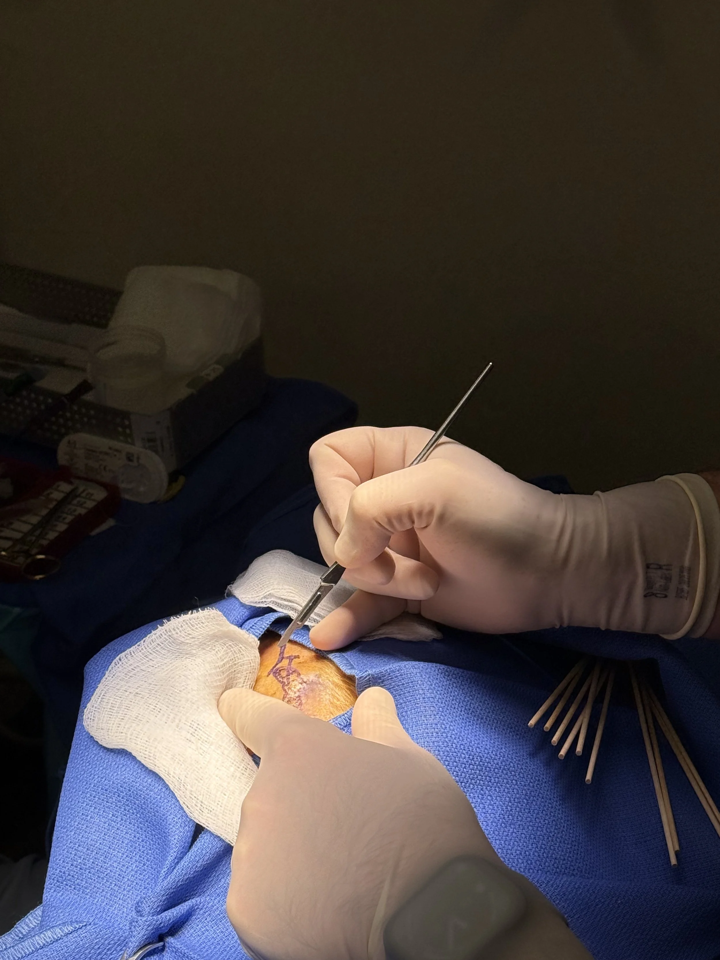 Surgeon performing a procedure on a patient’s leg with surgical tools in a sterile environment.