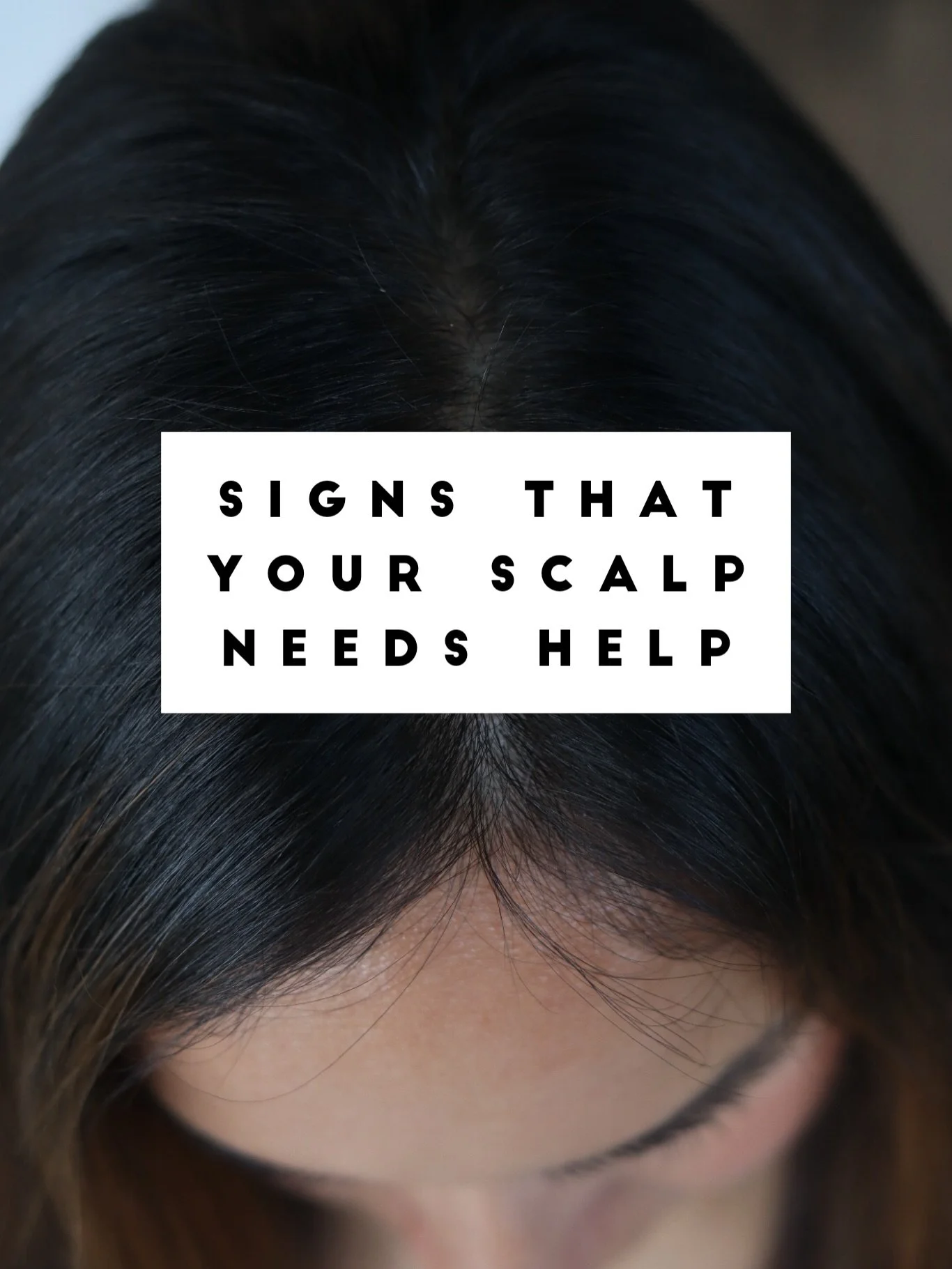 Let&rsquo;s talk scalp health. I know, we&rsquo;re always yapping about scalp care, but that&rsquo;s because it&rsquo;s important! 

Yes&mdash;there&rsquo;s lots of reasons why you might not be happy with your hair. But it starts with the scalp. A st