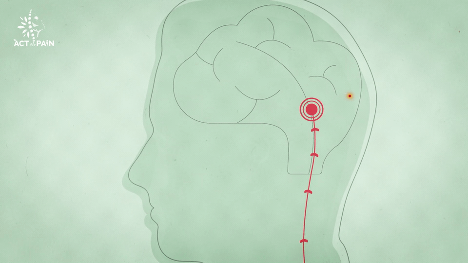 Pain Management Module