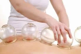 Cupping