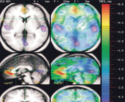 Does Weed Aid Creativity?