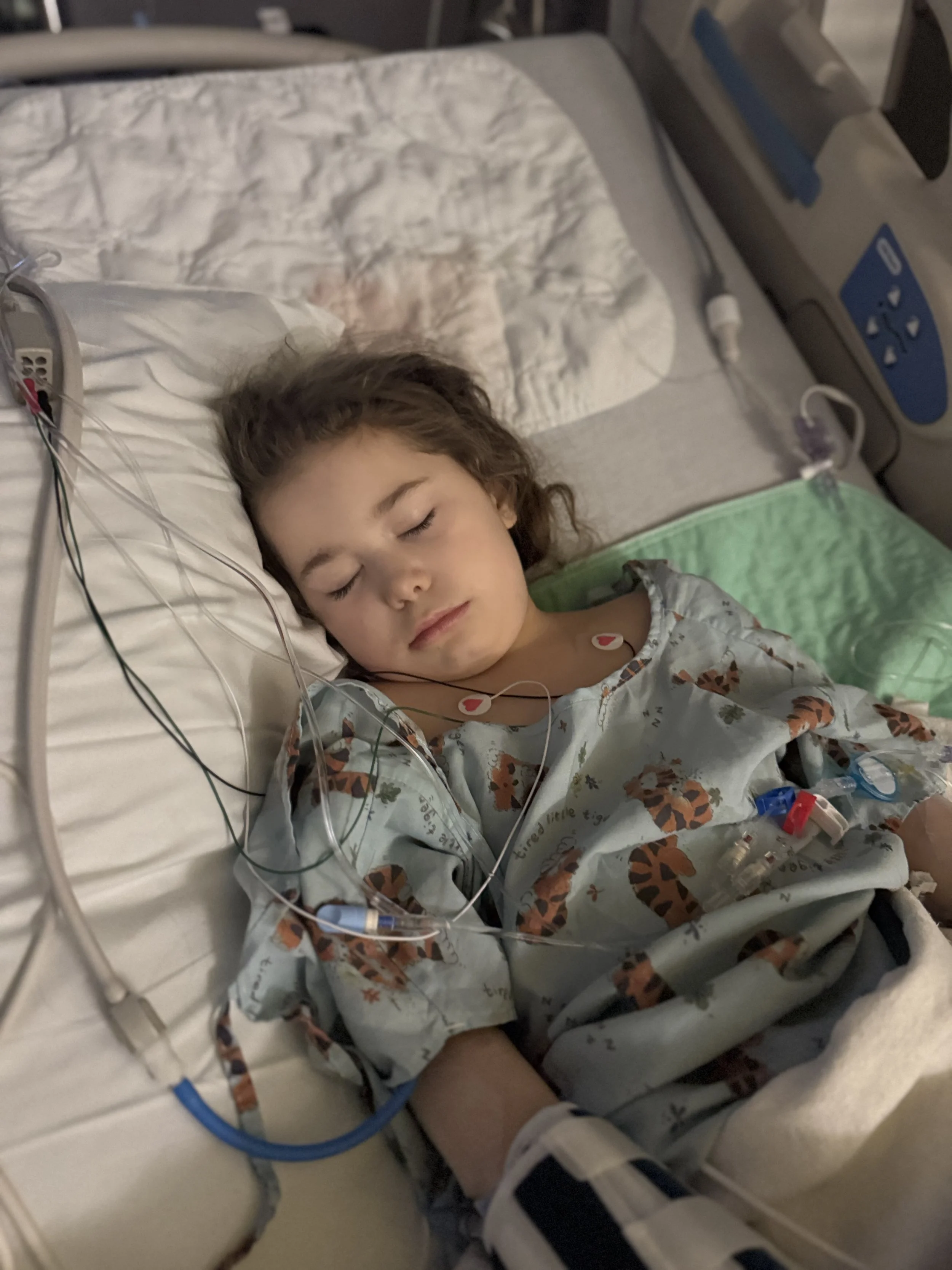 Brain surgery #4