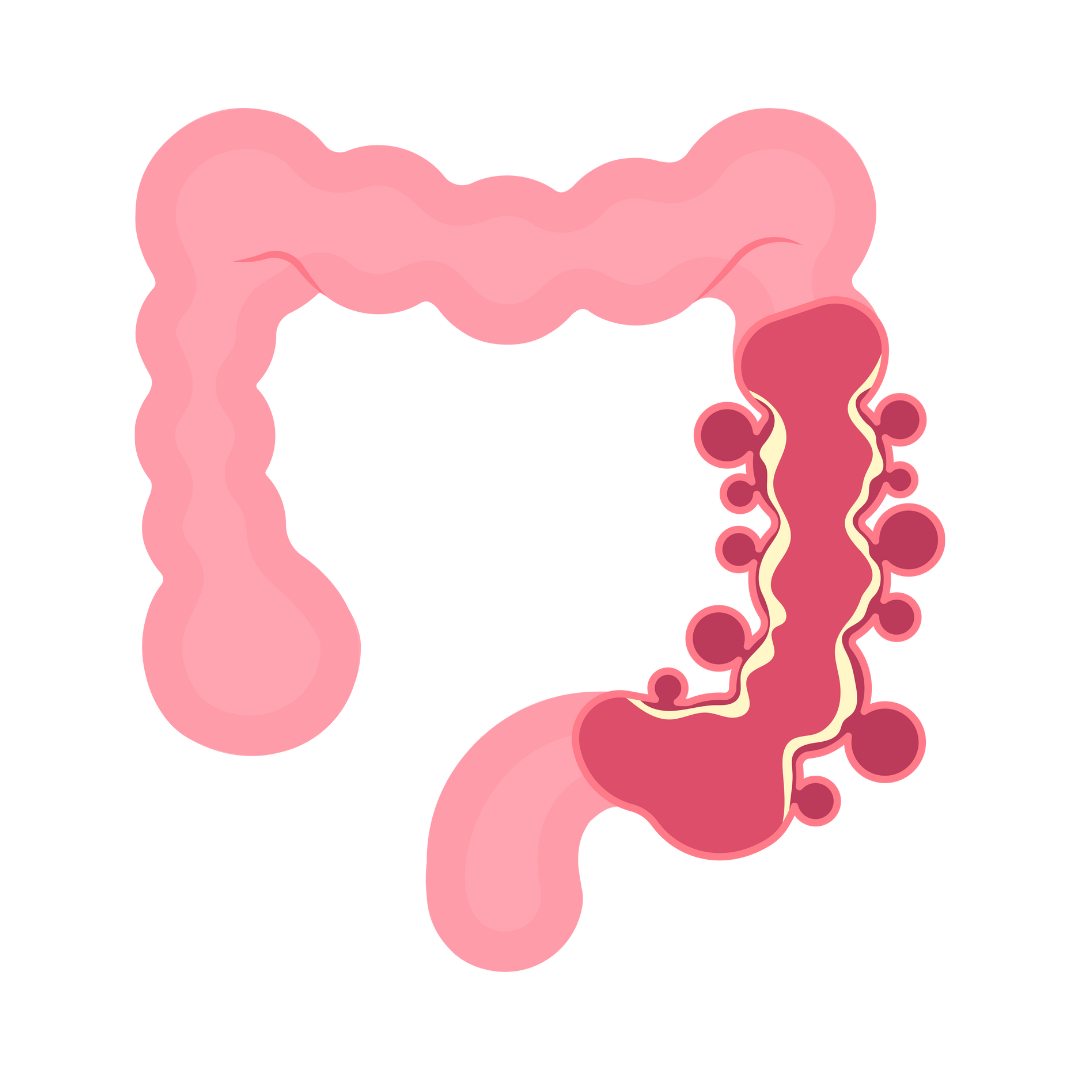 Endometriosis Patient Resources & Support Guide | Endo Excision for All ...