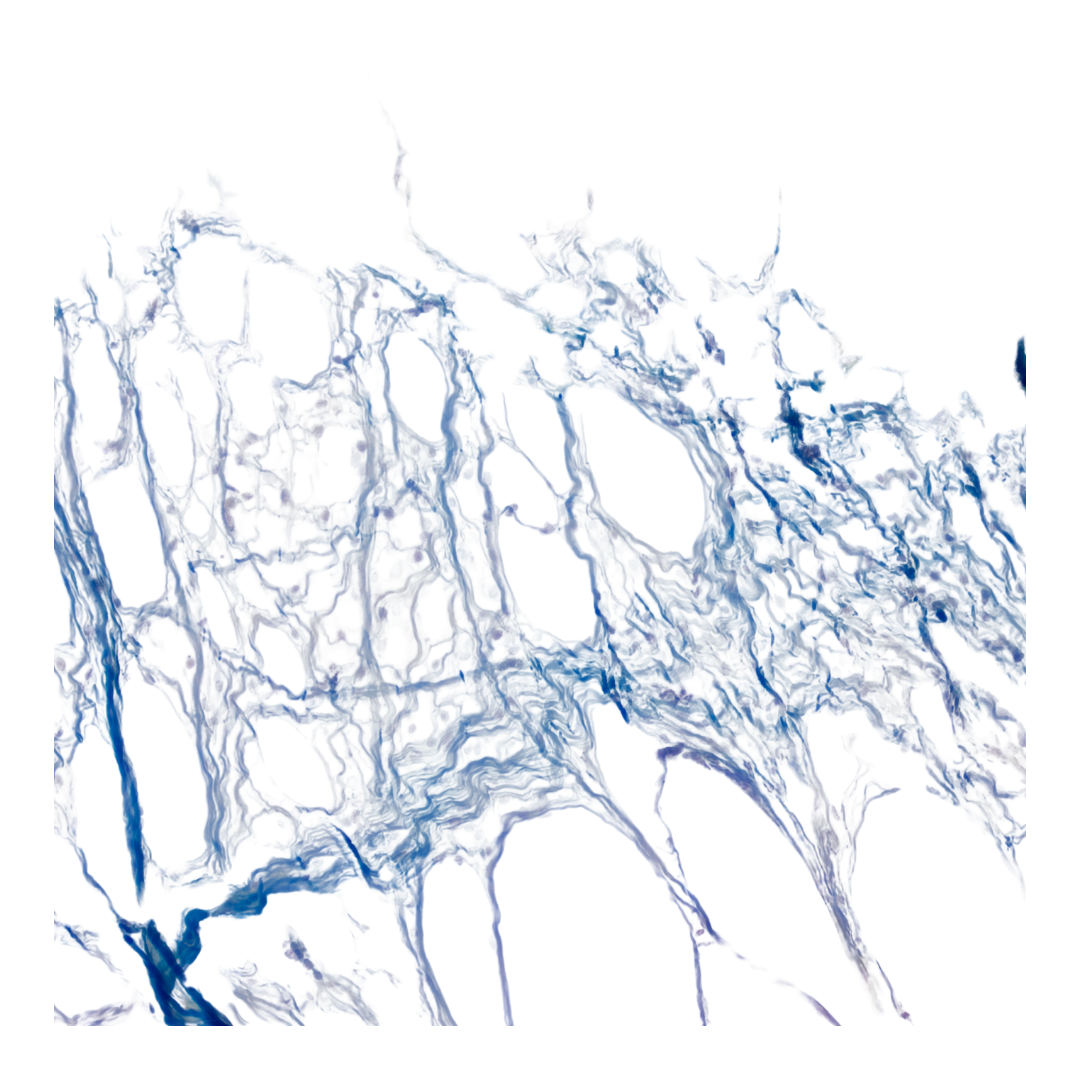 Understanding What the Colors of Endometriosis Lesions May Tell Us