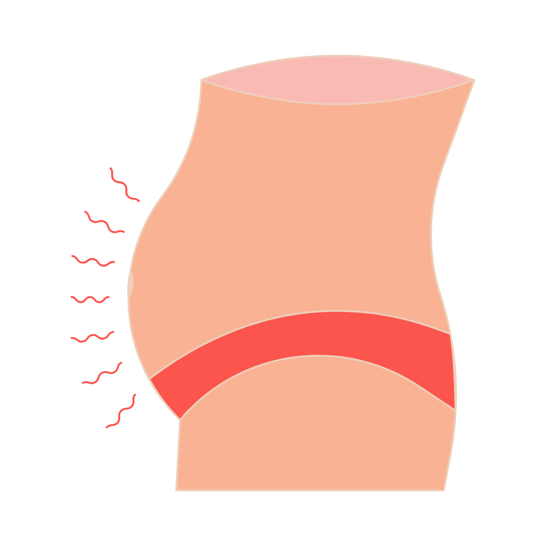 Endo Belly: What’s Actually Going On