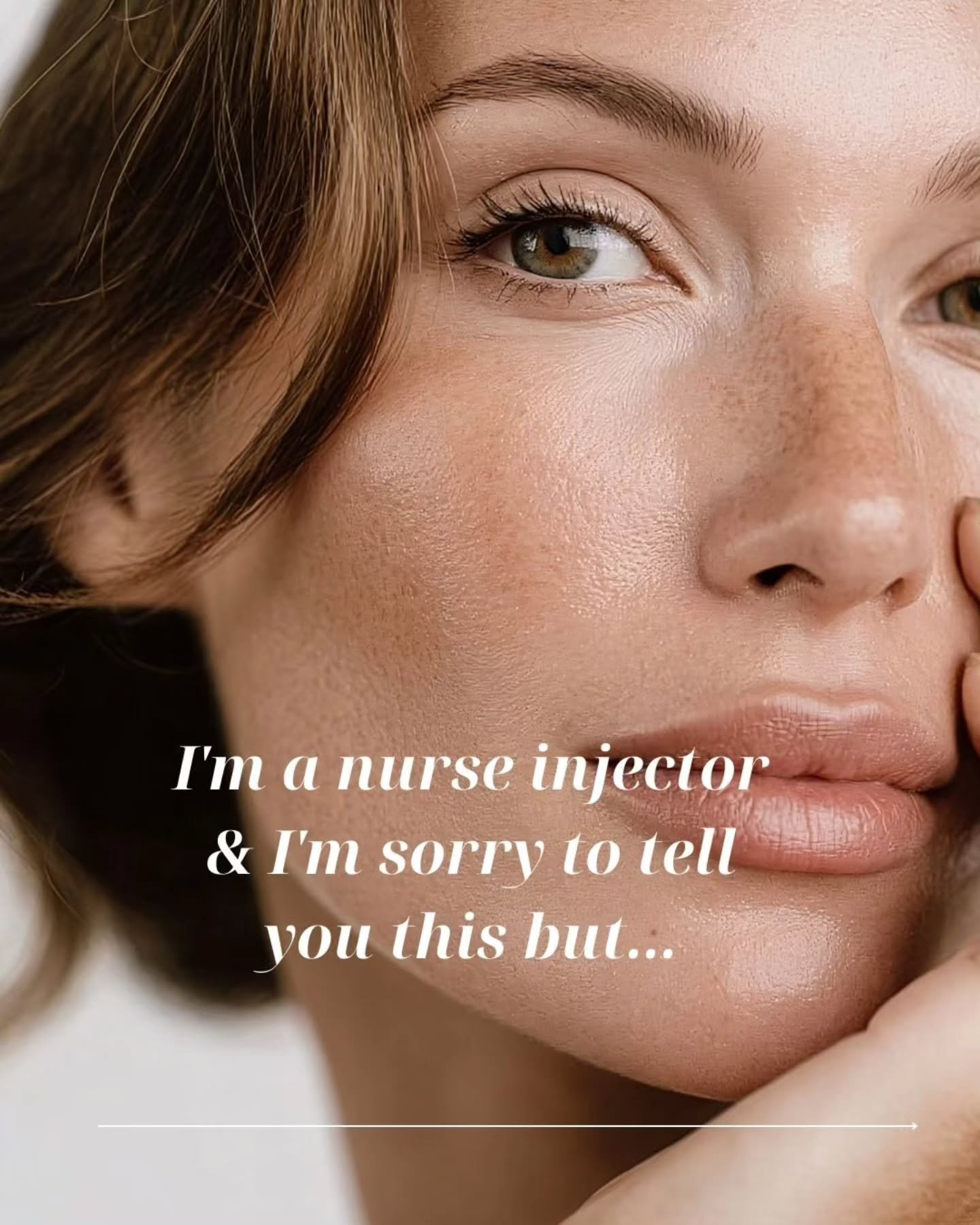 I&rsquo;m a nurse injecto and I&rsquo;m sorry to tell you this but...

1. Anti-wrinkle works BEST at preventing, not reversing.

Anti-wrinkle relaxes the muscle so etched lines stop worsening and gradually soften over time.
If you start early, you ma
