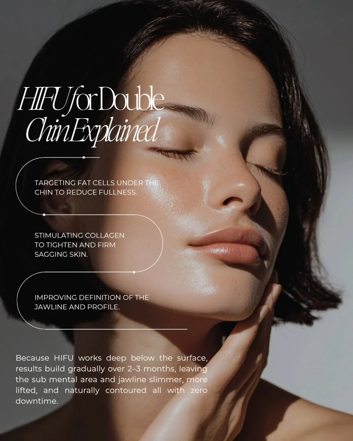 ✨️HIFU for Chin Fat Reduction ✨

Not all fullness under the chin is about weight often it&rsquo;s a combination of fat, skin laxity, and loss of structural support.

HIFU (High-Intensity Focused Ultrasound) delivers controlled ultrasound energy to pr