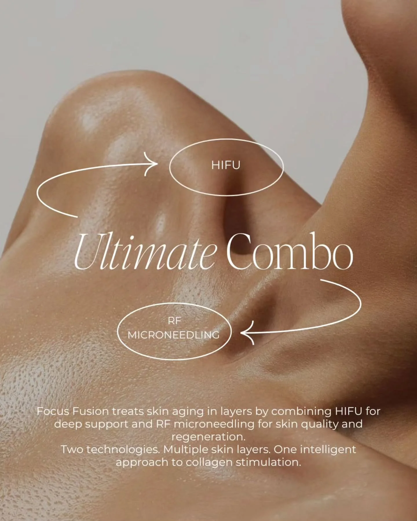 Focus Fusion ✨ | HIFU + RF Microneedling

Some treatments work beautifully on their own.
Others work even better together.

Focus Fusion combines HIFU and RF microneedling to target aging on multiple levels, because the skin doesn&rsquo;t age in just