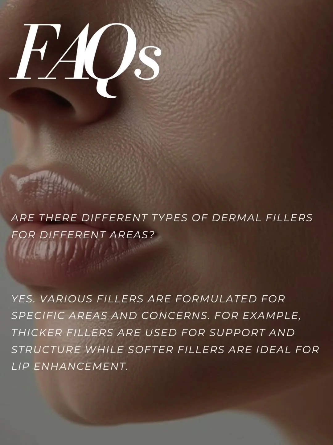 WHY WE NEED DIFFERENT FILLERS FOR DIFFERENT AREAS OF THE FACE

Using one product everywhere is like using the same paintbrush for fine art and house painting&hellip; it just doesn&rsquo;t make sense. Think about what we are actually treating in a ful