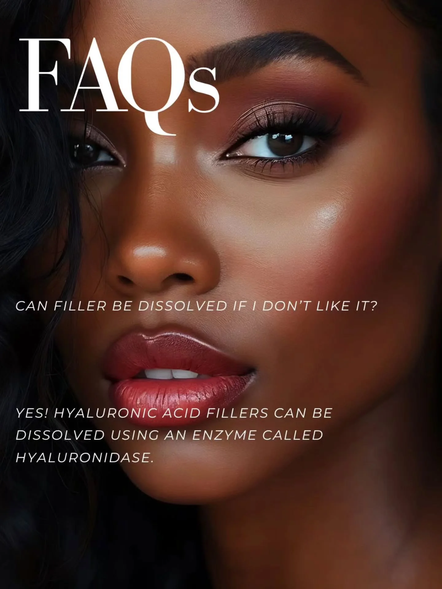 If you&rsquo;ve had dermal filler and you&rsquo;re not loving the result, the good news is hyaluronic acid (HA) fillers can be safely dissolved. You&rsquo;re not stuck with it.

Here&rsquo;s what you should know:

💉 What Fillers Can Be Dissolved?

F