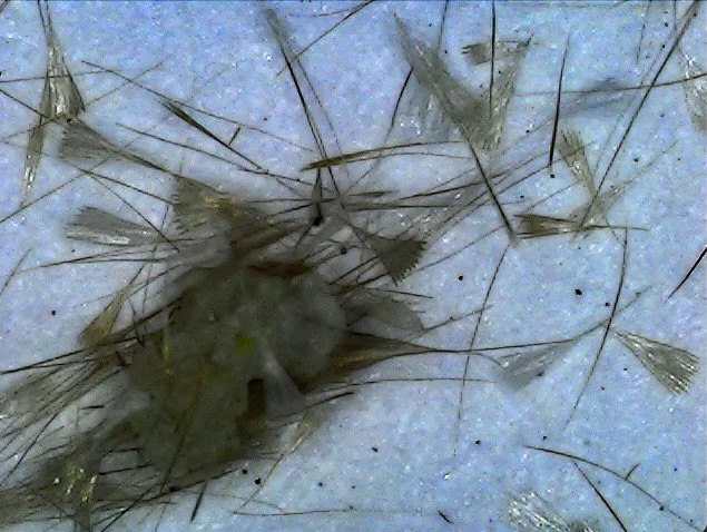 Wattle Cup Moth scales