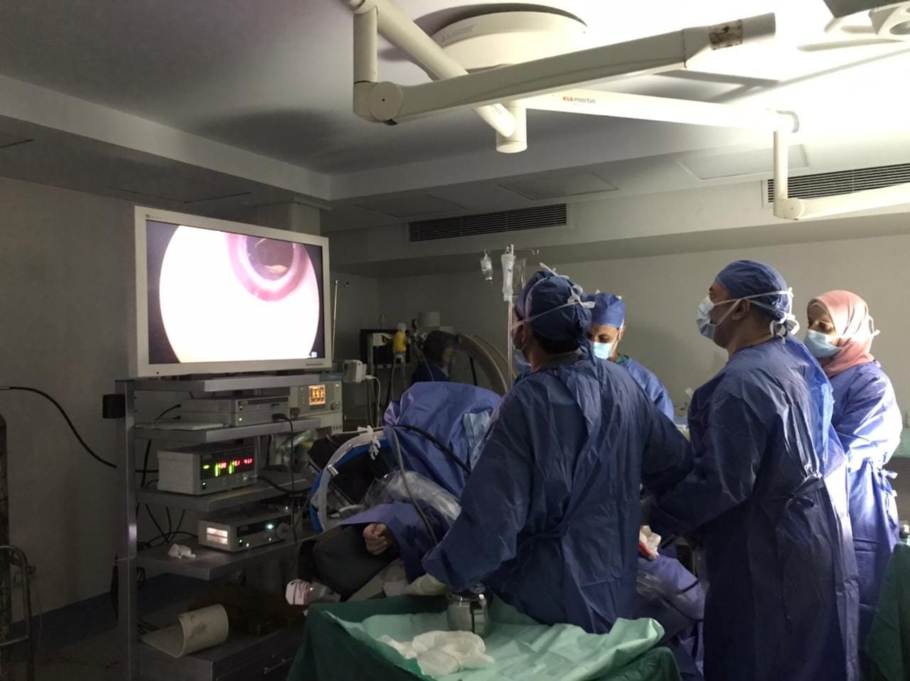 Medical team in surgical room performing endoscopy, with monitor displaying inside of patient's gastrointestinal tract.