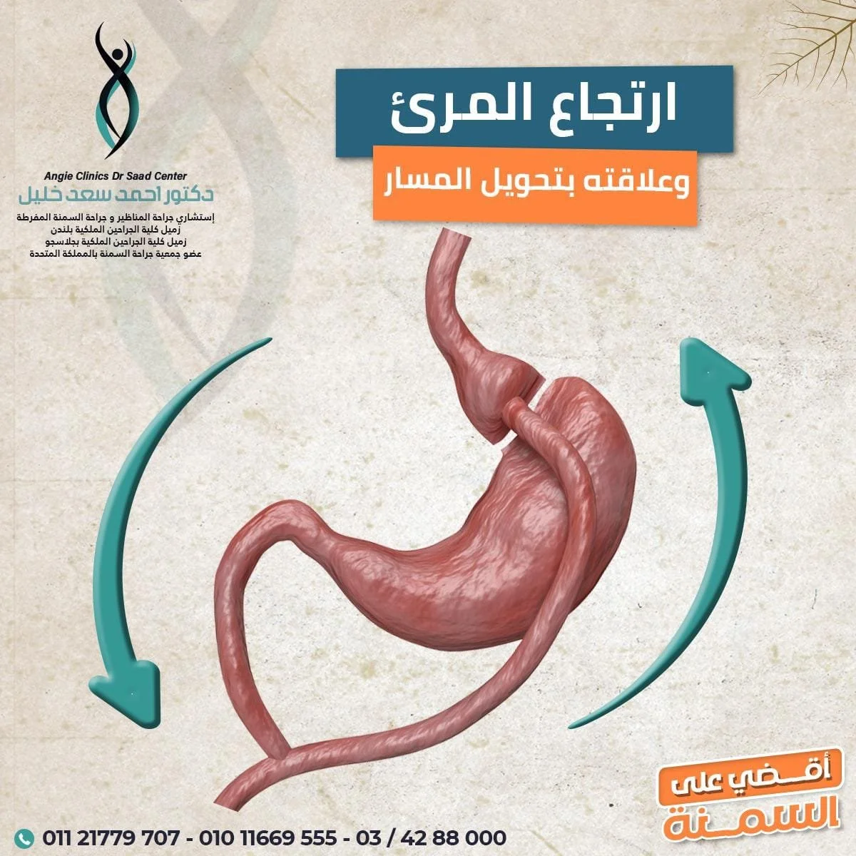 gastric bypass dr ahmed saad khalil