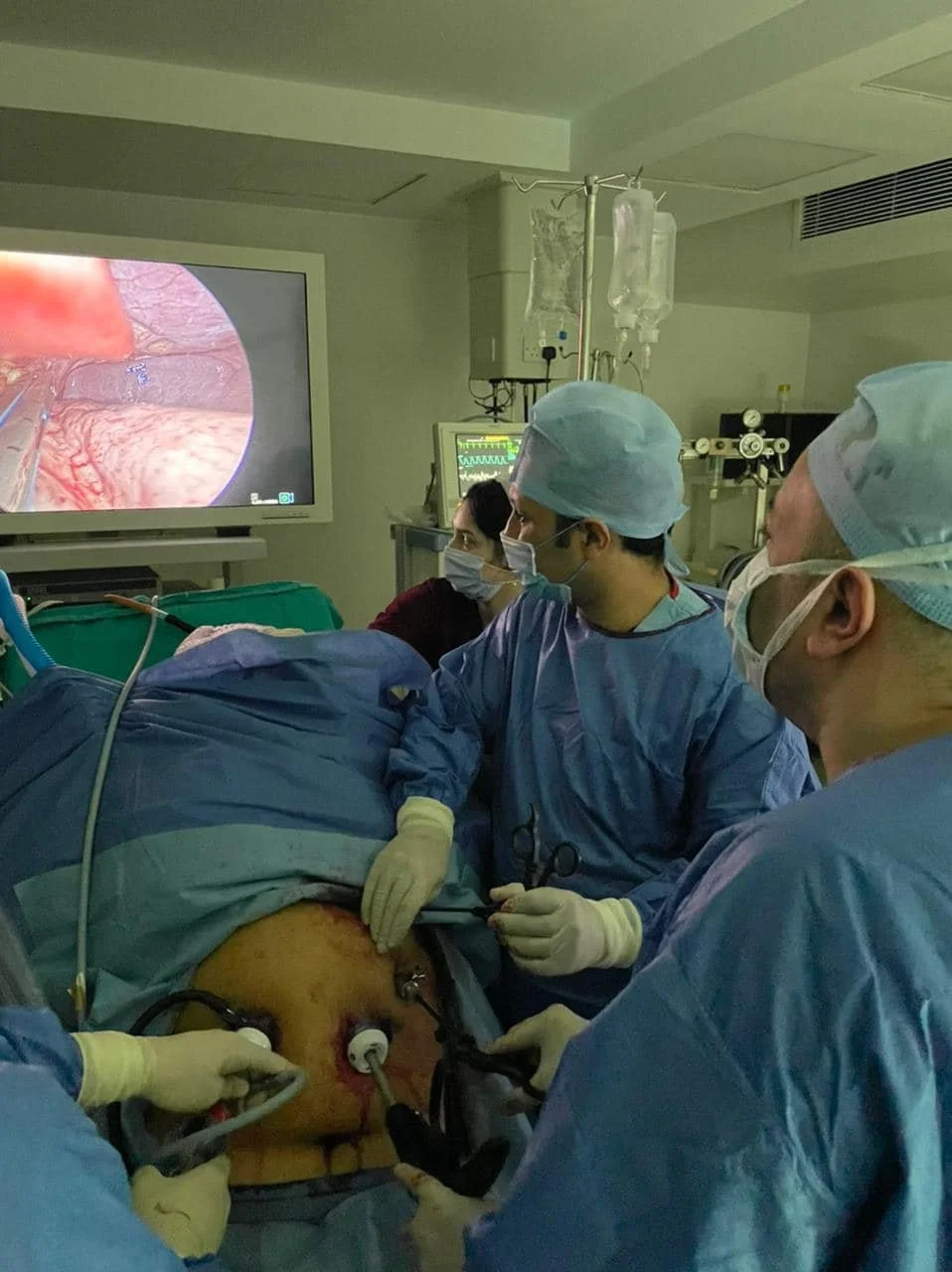 dr ahmed saad khalil operating sleeve gastrectomy egypt