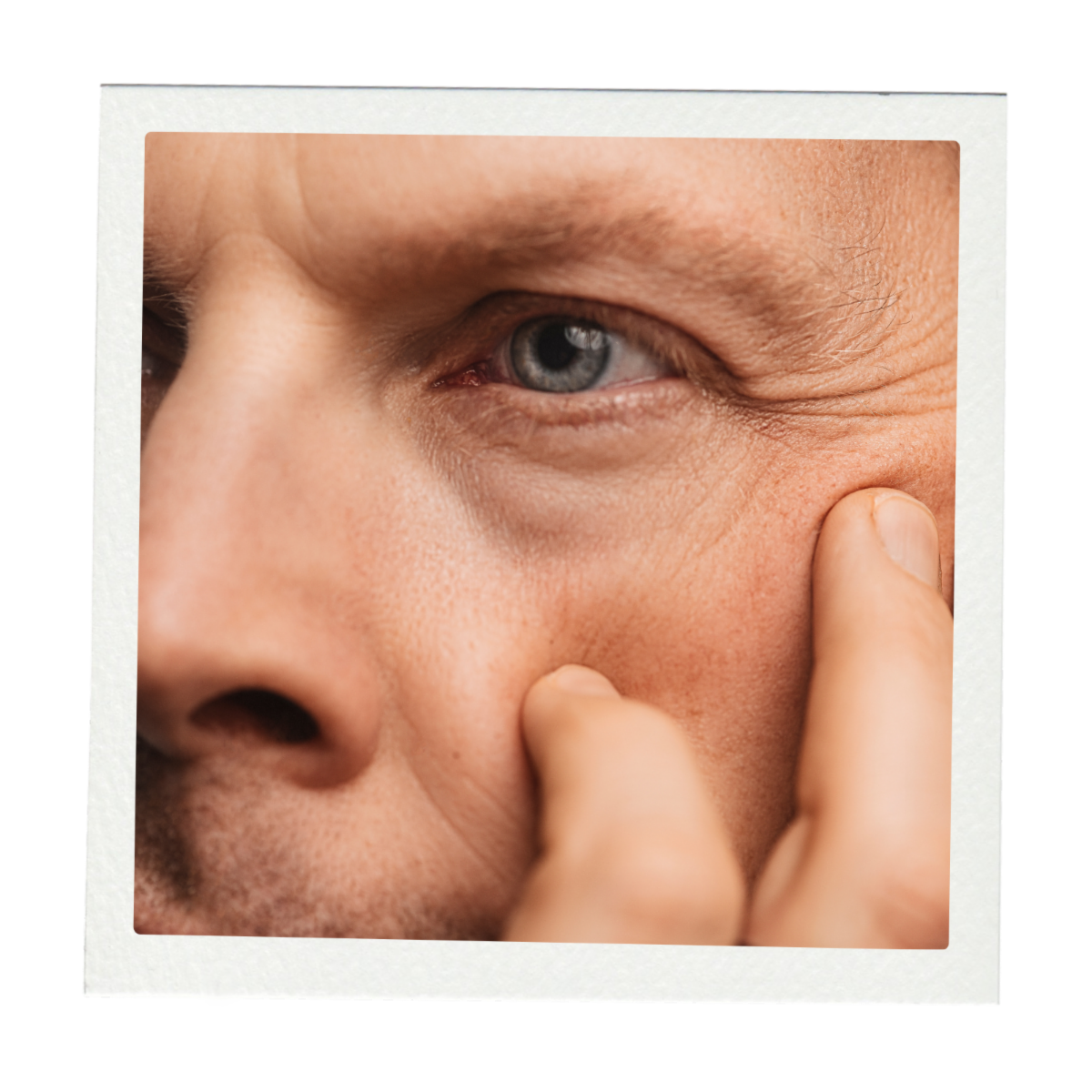 Lasers, Explained: Finding the Right Treatment for Your Skin — SKN ...