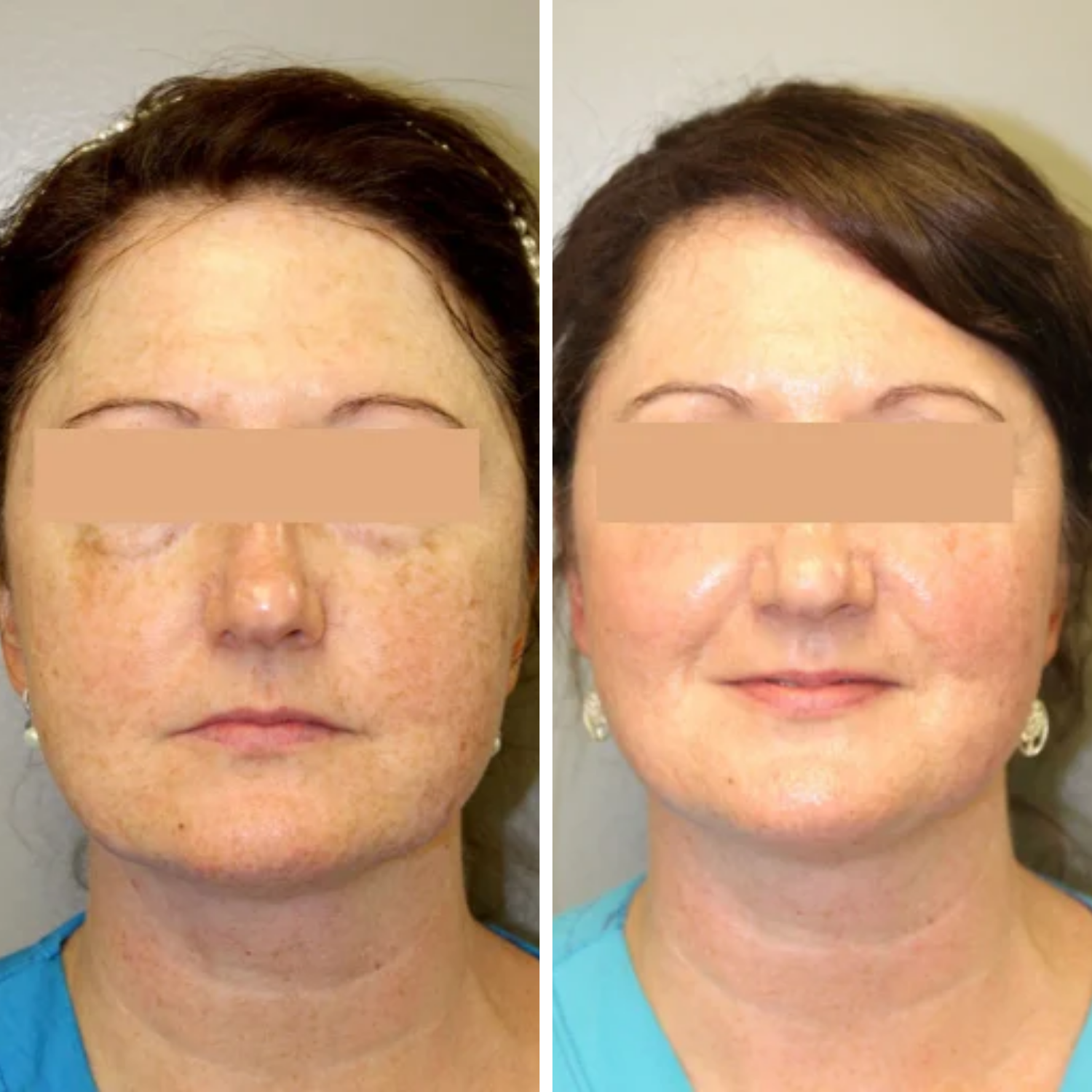 CoolPeel (2).png